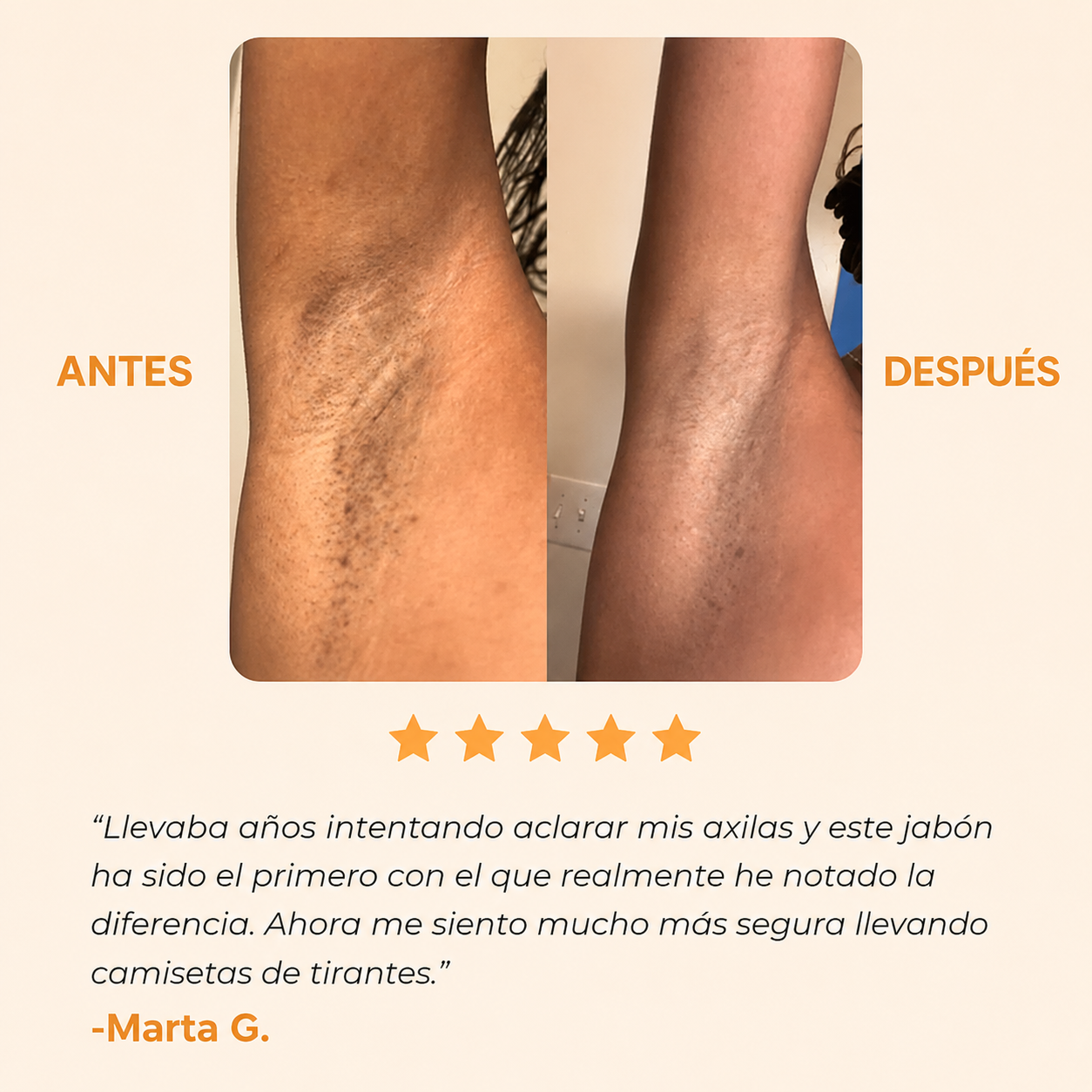 Jabón Antimanchas con Ácido Kójico