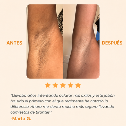 Jabón Antimanchas con Ácido Kójico