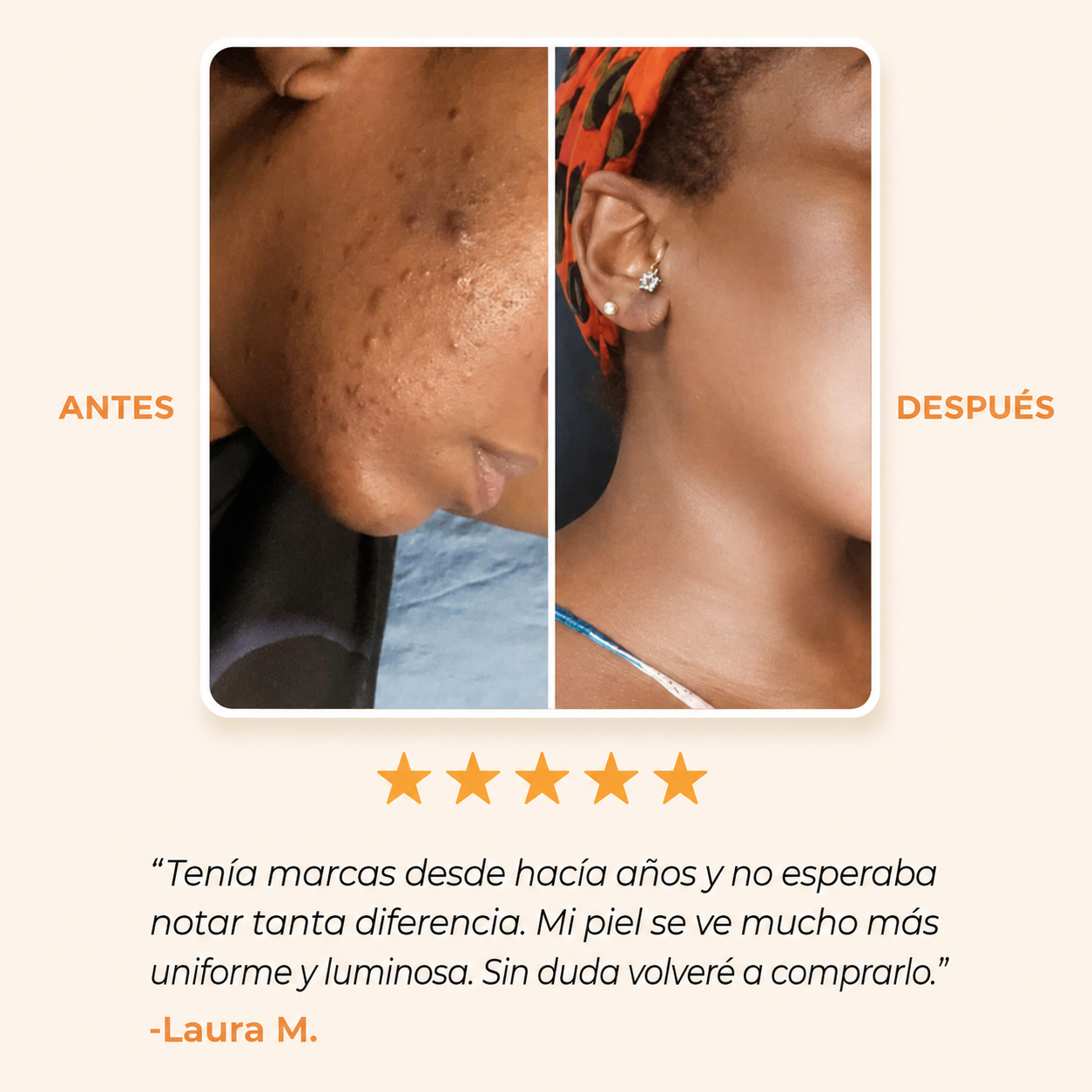 Jabón Antimanchas con Ácido Kójico