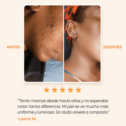 Jabón Antimanchas con Ácido Kójico